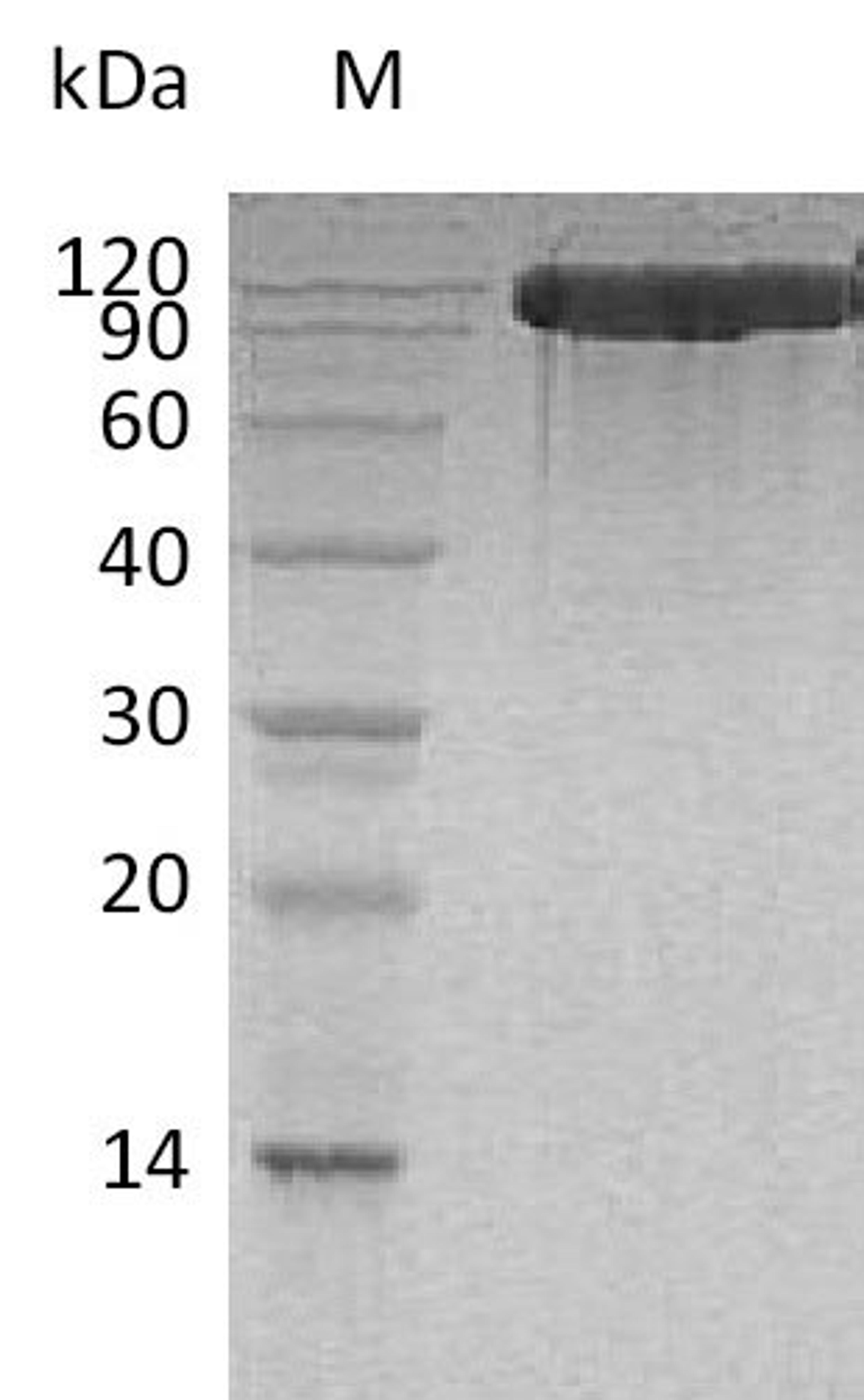 (Tris-Glycine gel) Discontinuous SDS-PAGE (reduced) with 5% enrichment gel and 15% separation gel.