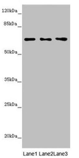 Western blot. All lanes: STXBP2 antibody at 4.1µg/ml. Lane 1: Mouse gonadal tissue. Lane 2: Jurkat whole cell lysate. Lane 3: A549 whole cell lysate. Secondary. Goat polyclonal to rabbit IgG at 1/10000 dilution. Predicted band size: 67, 68 kDa. Observed band size: 67 kDa