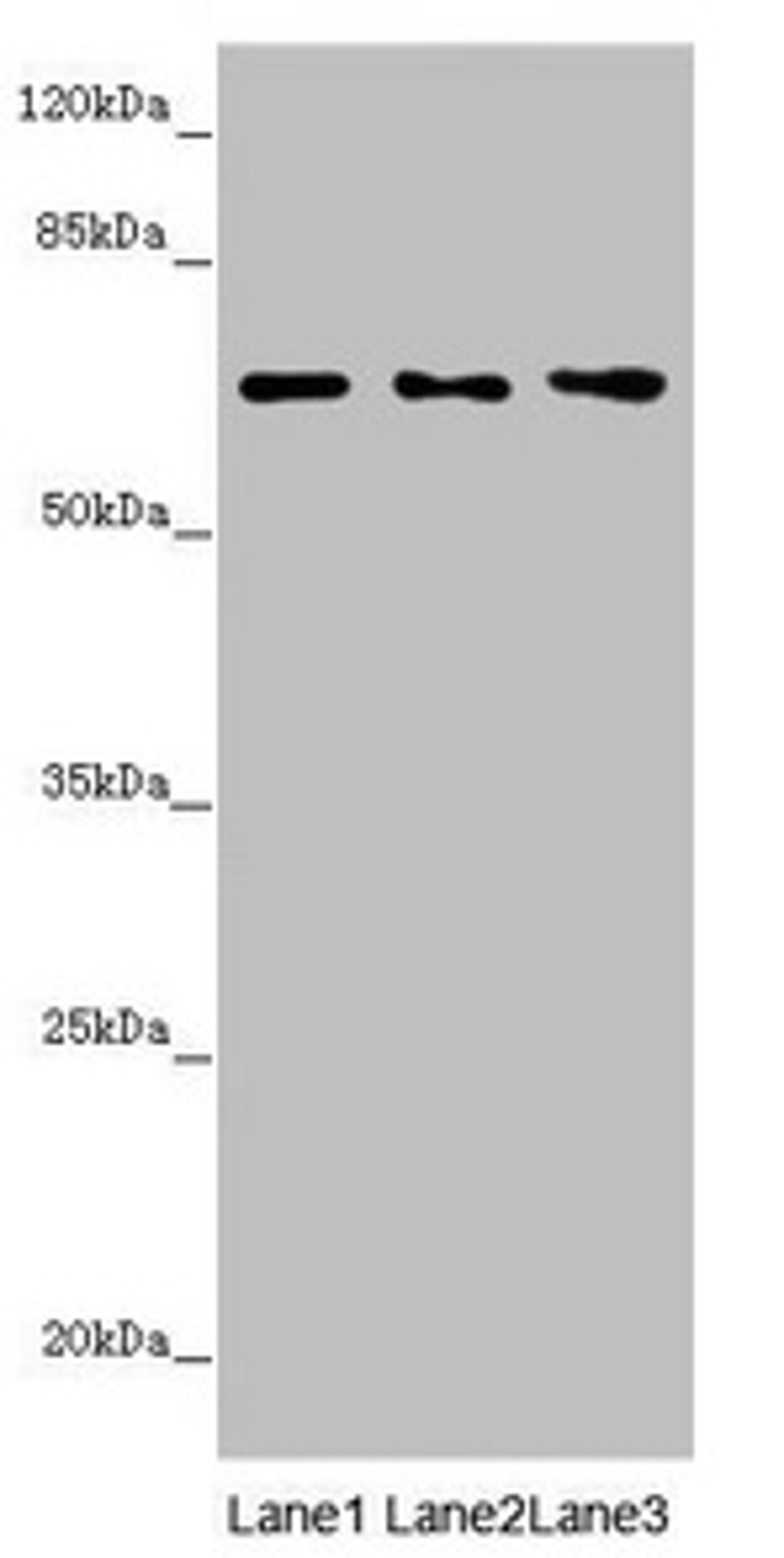 Western blot. All lanes: STXBP2 antibody at 4.1µg/ml. Lane 1: Mouse gonadal tissue. Lane 2: Jurkat whole cell lysate. Lane 3: A549 whole cell lysate. Secondary. Goat polyclonal to rabbit IgG at 1/10000 dilution. Predicted band size: 67, 68 kDa. Observed band size: 67 kDa