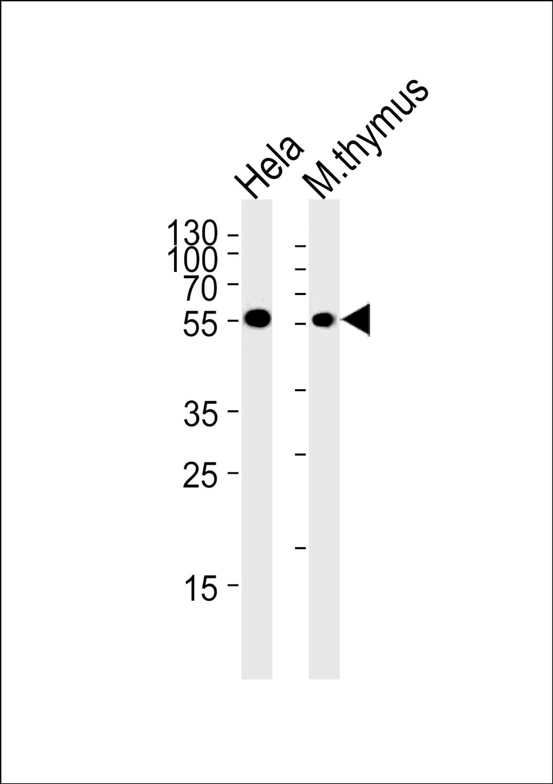 Western blot analysis in Hela cell line and mouse thymus tissue lysates (35ug/lane).