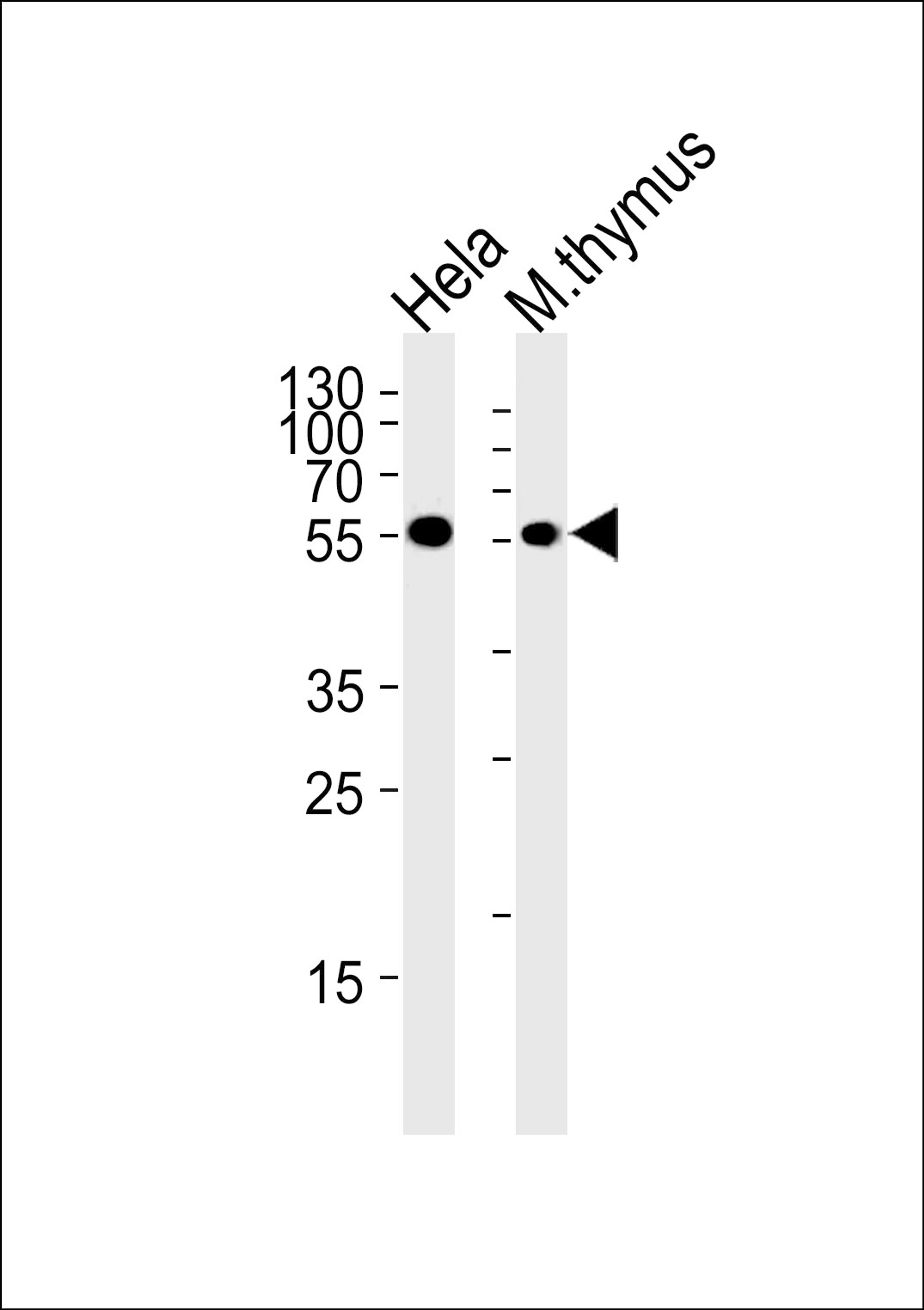 Western blot analysis in Hela cell line and mouse thymus tissue lysates (35ug/lane).