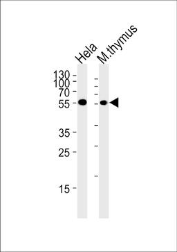 Western blot analysis in Hela cell line and mouse thymus tissue lysates (35ug/lane).