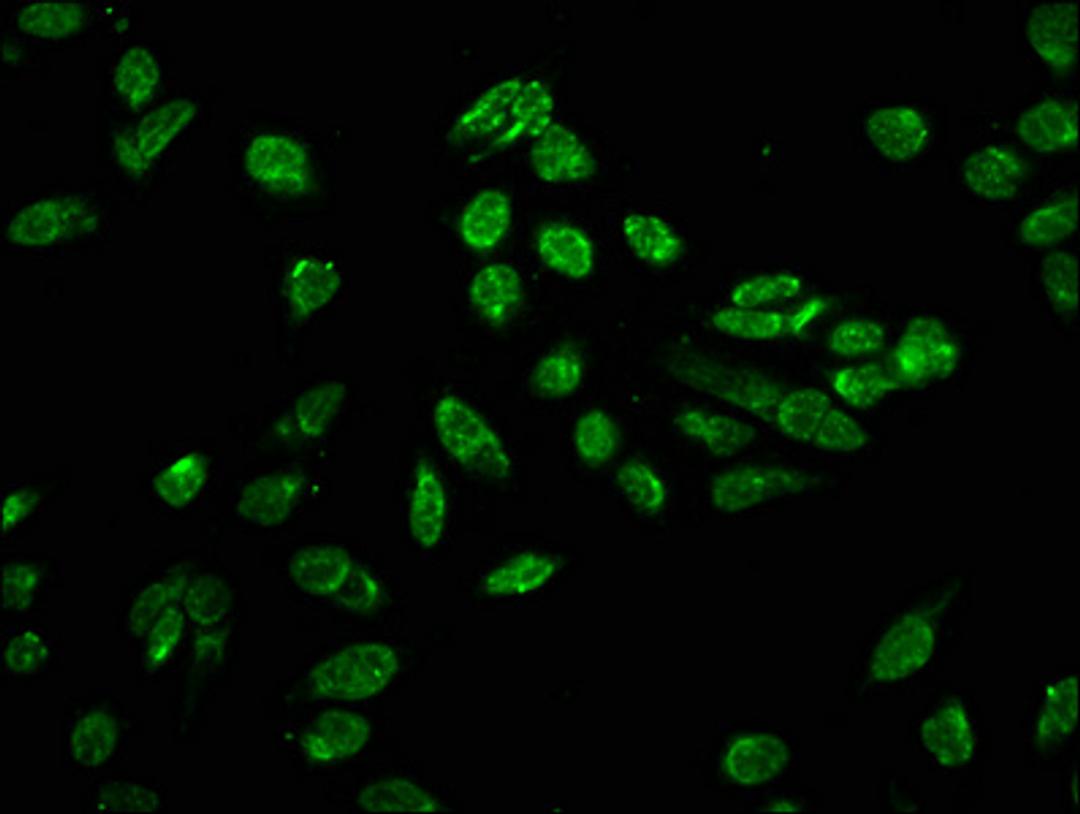 Immunofluorescence staining of Hela cells with CSB-PA010418OA80phHU at 1:10, counter-stained with DAPI. The cells were fixed in 4% formaldehyde, permeabilized using 0.2% Triton X-100 and blocked in 10% normal Goat Serum. The cells were then incubated with the antibody overnight at 4°C. The secondary antibody was Alexa Fluor 488-congugated AffiniPure Goat Anti-Rabbit IgG(H+L).
