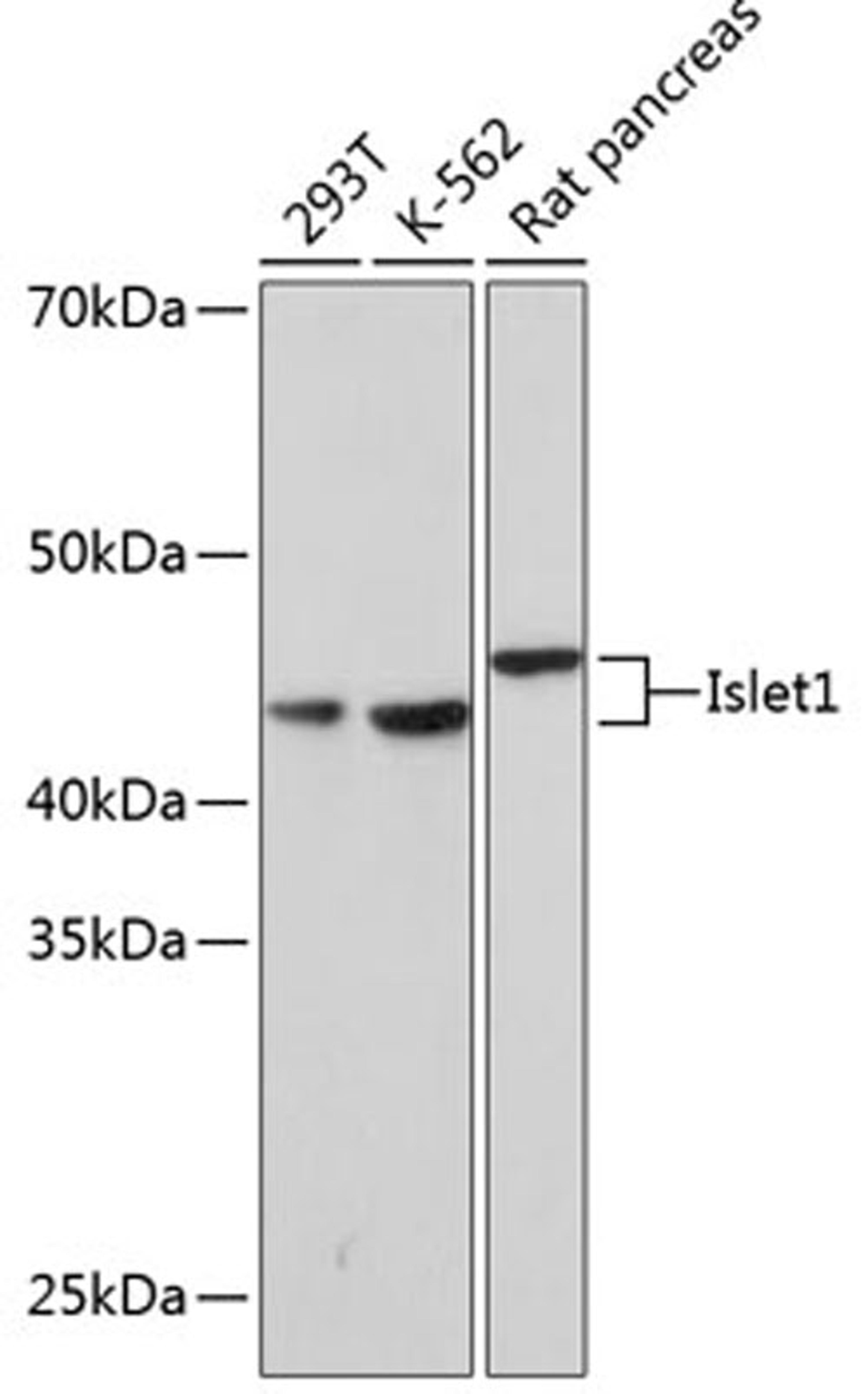 Western blot - Islet1 Rabbit mAb (A0871)