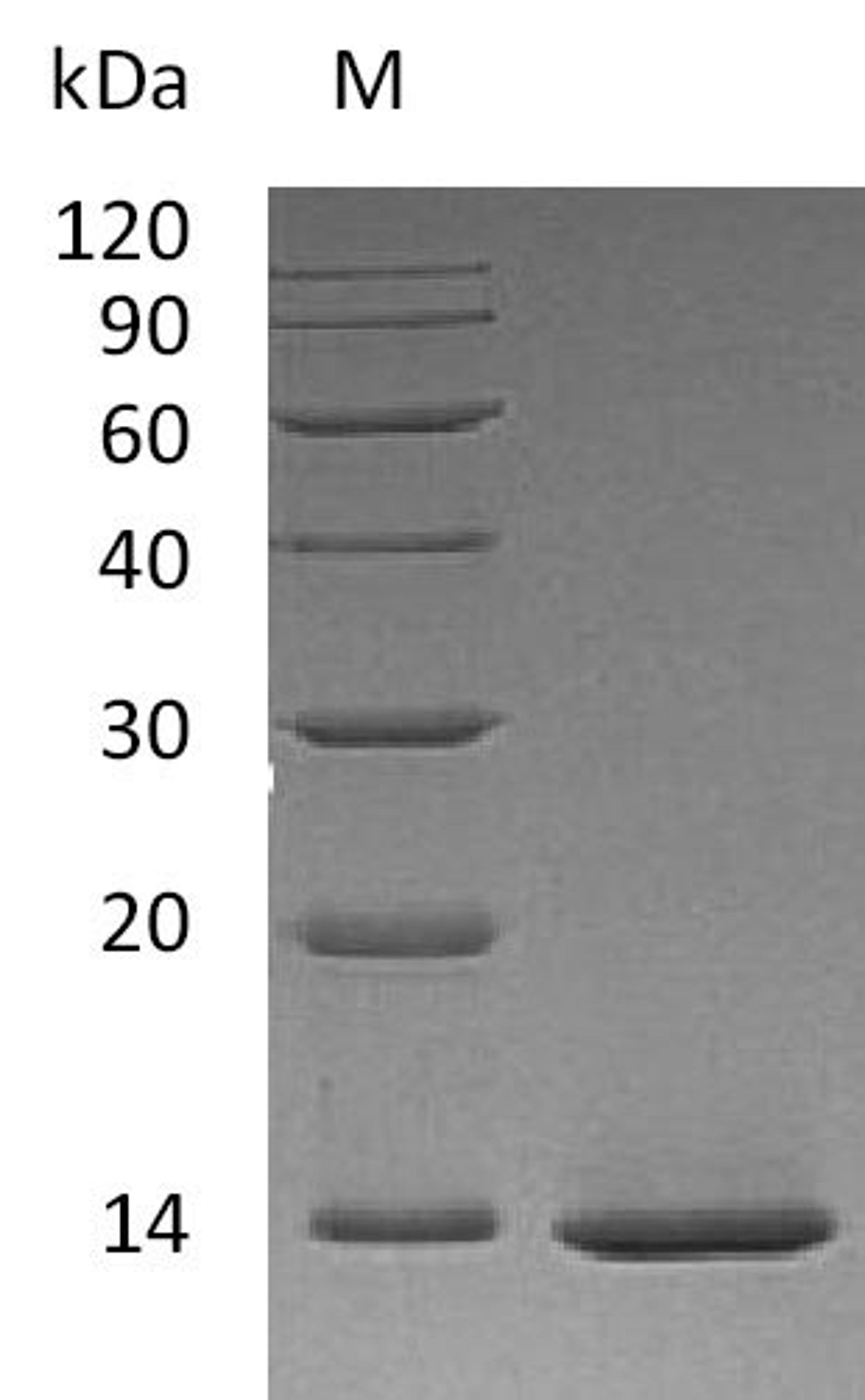 (Tris-Glycine gel) Discontinuous SDS-PAGE (reduced) with 5% enrichment gel and 15% separation gel.