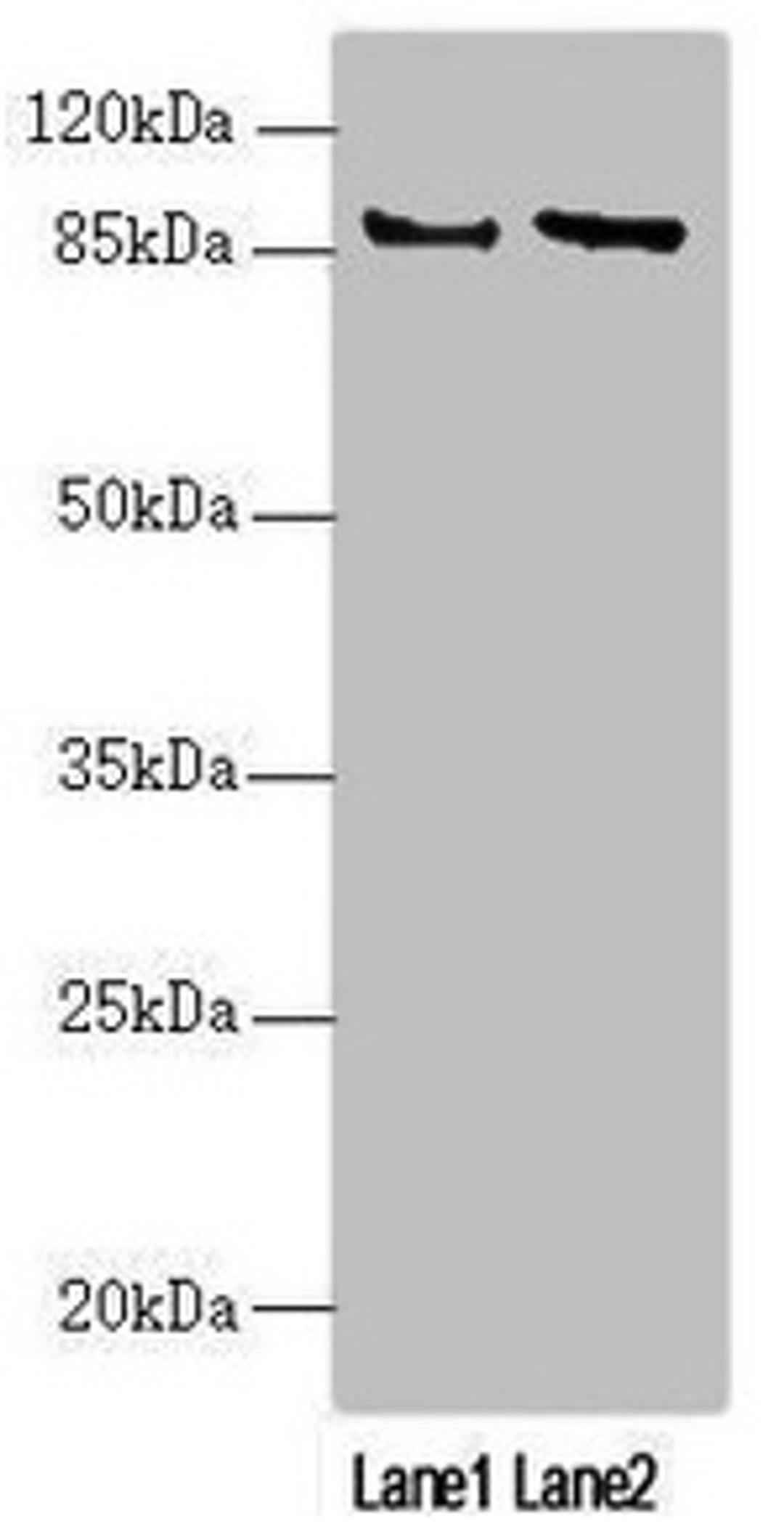 Western blot. All lanes: MAPK8IP2 antibody at 2.85µg/ml. Lane 1: U251 whole cell lysate. Lane 2: A549 whole cell lysate. Secondary. Goat polyclonal to rabbit IgG at 1/10000 dilution. Predicted band size: 88, 85, 65, 50 kDa. Observed band size: 88 kDa