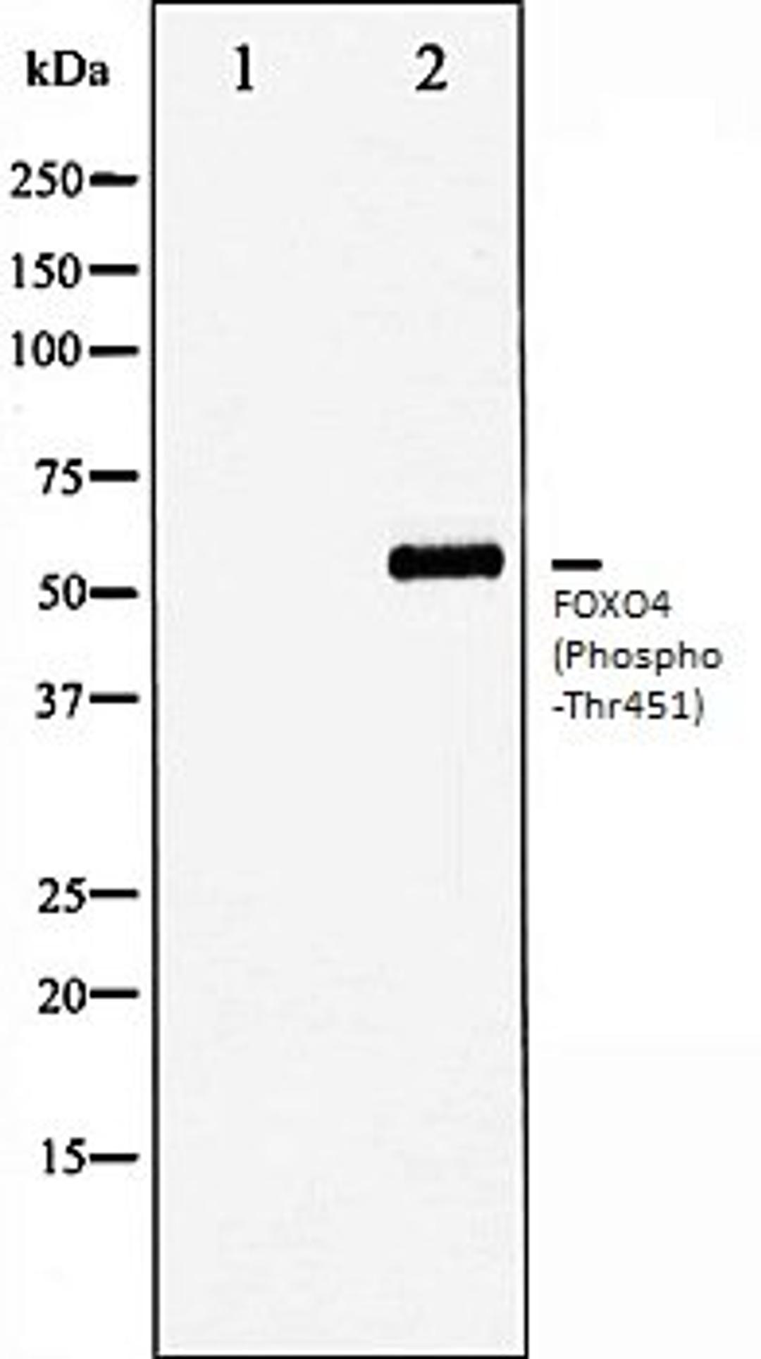 Western blot analysis of HuvEc whole cell lysates using FOXO4 (Phospho-Thr451) antibody, The lane on the left is treated with the antigen-specific peptide.