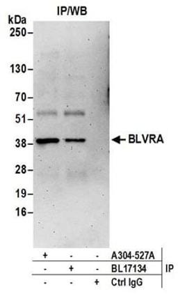 Detection of human BLVRA by western blot of immunoprecipitates.