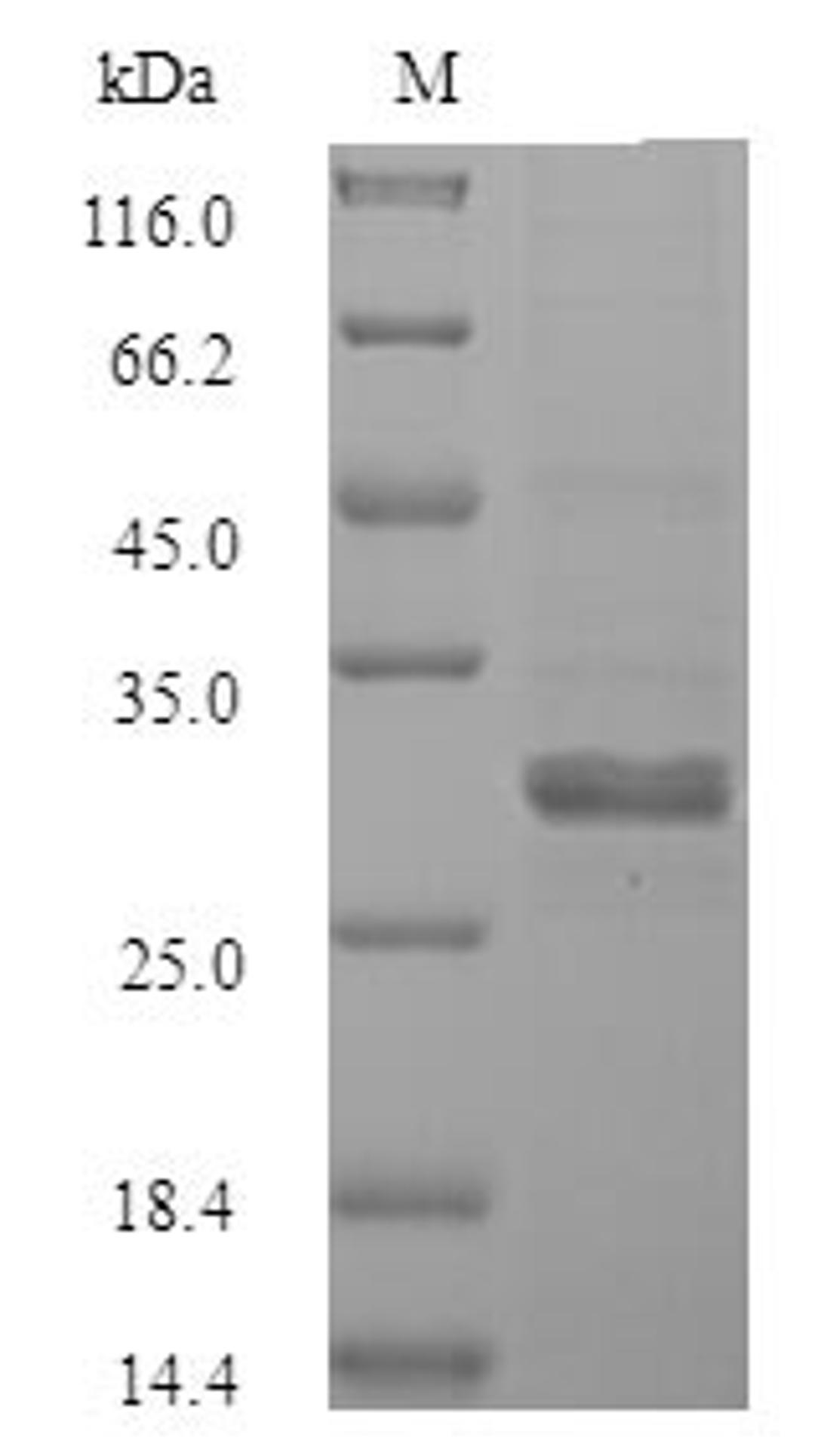 (Tris-Glycine gel) Discontinuous SDS-PAGE (reduced) with 5% enrichment gel and 15% separation gel.
