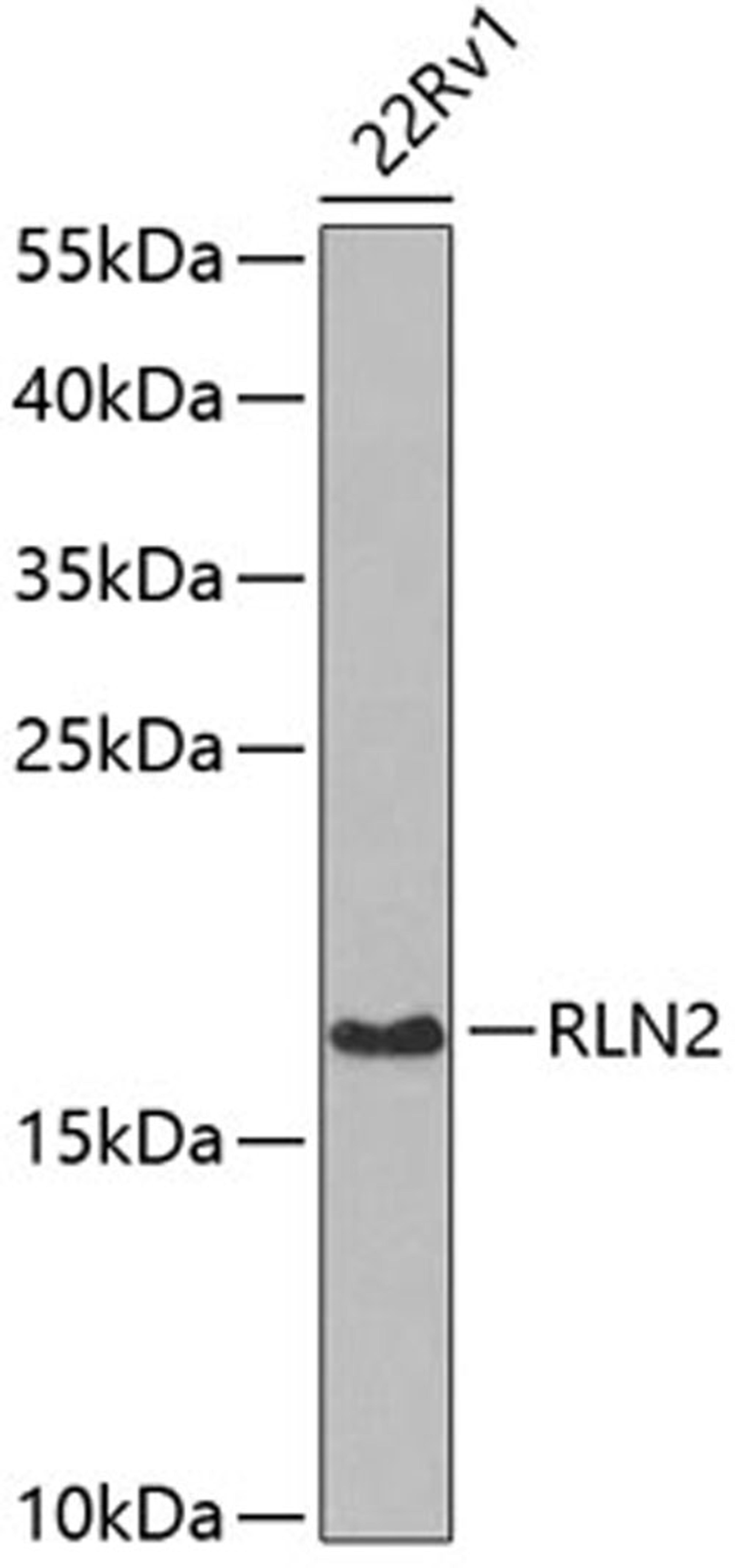 Western blot - RLN2 antibody (A6969)