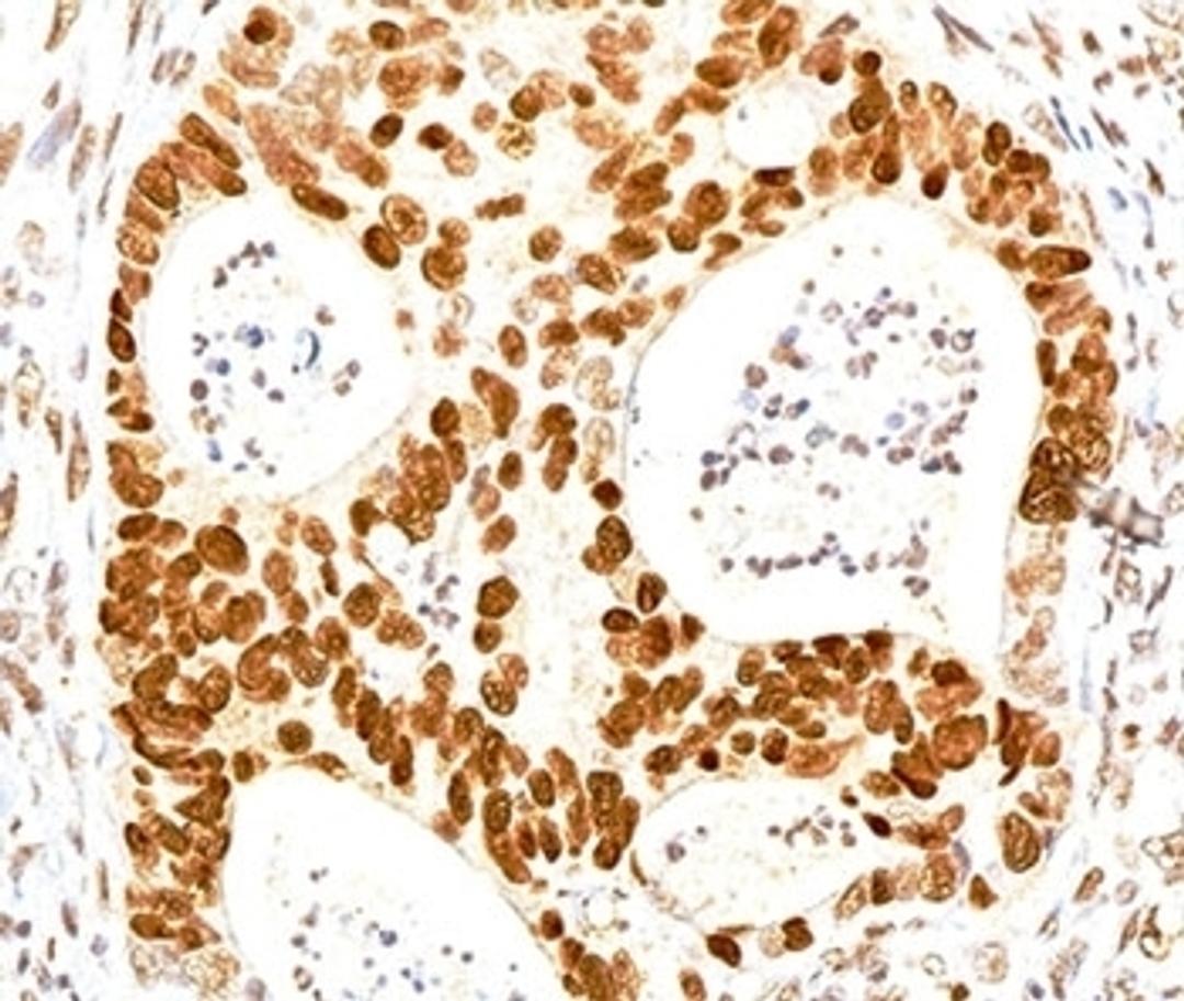 IHC testing of human colon stained with p27Kip1 antibody.