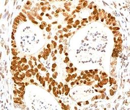 IHC testing of human colon stained with p27Kip1 antibody.