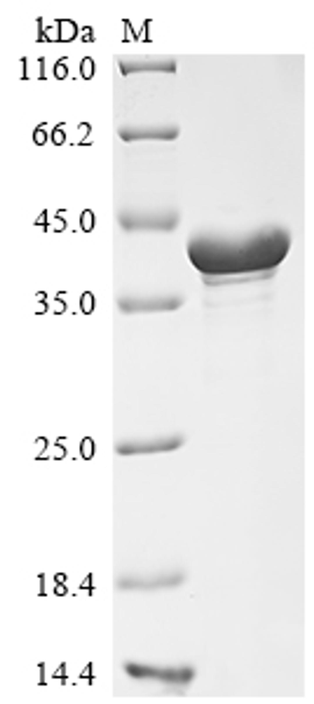 (Tris-Glycine gel) Discontinuous SDS-PAGE (reduced) with 5% enrichment gel and 15% separation gel.
