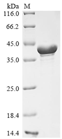 (Tris-Glycine gel) Discontinuous SDS-PAGE (reduced) with 5% enrichment gel and 15% separation gel.