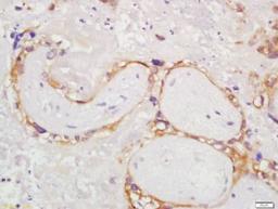 Immunohistochemical staining of human placenta tissue using Epiphycan antibody.