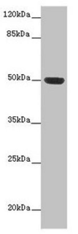 Western blot. All lanes: HTR3D antibody at 2µg/ml + Hela whole cell lysate. Secondary. Goat polyclonal to rabbit IgG at 1/10000 dilution. Predicted band size: 51, 31, 26, 46 kDa. Observed band size: 51 kDa