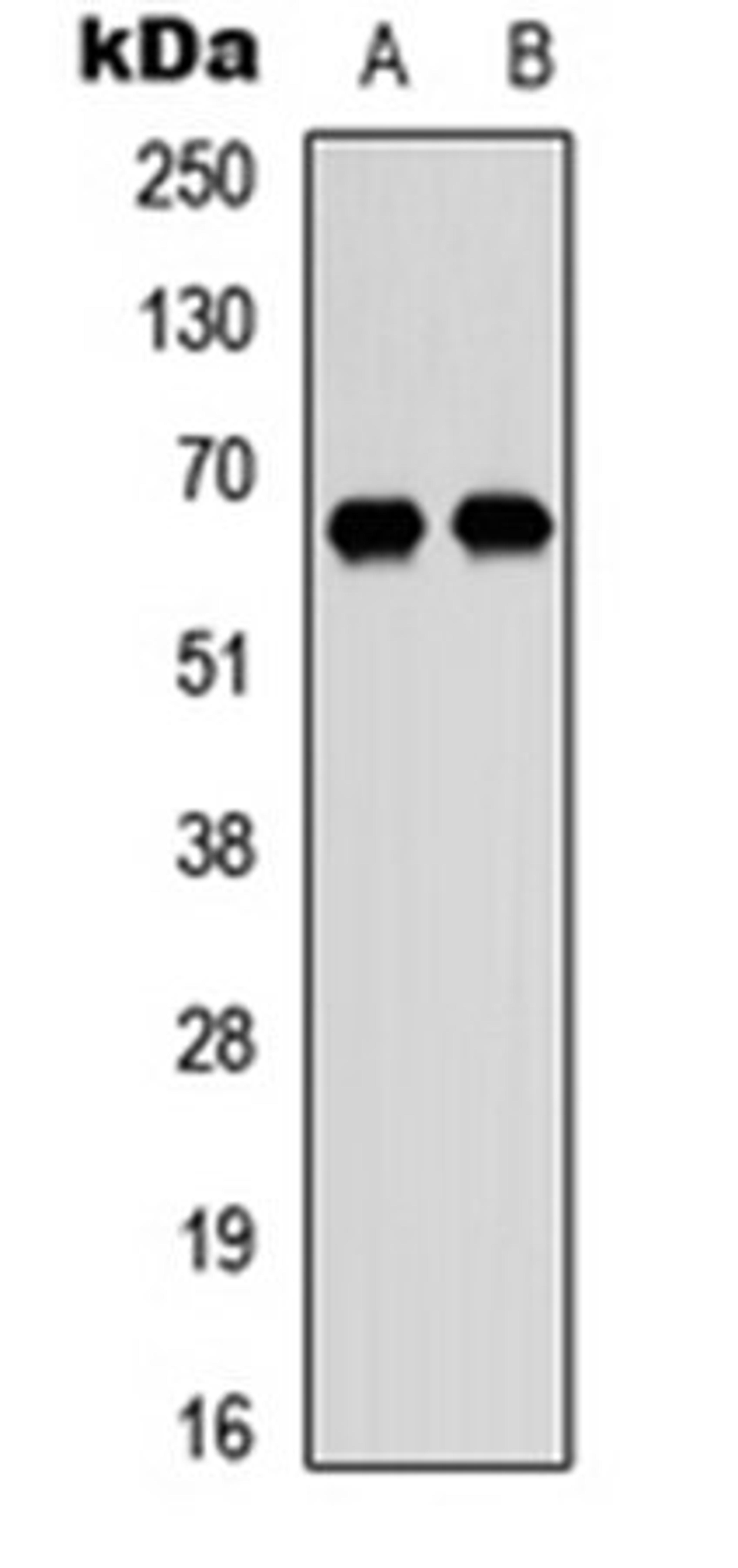 Western blot analysis of HEK293T (Lane 1), Raji (Lane 2) whole cell lysates using DDX52 antibody