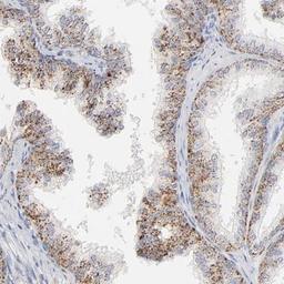 Immunohistochemistry: Latent TGF-beta bp2/LTBP-2 Antibody [NBP1-88411] - Immunohistochemical staining of human prostate shows strong cytoplasmic positivity in a granular pattern in glandular cells.