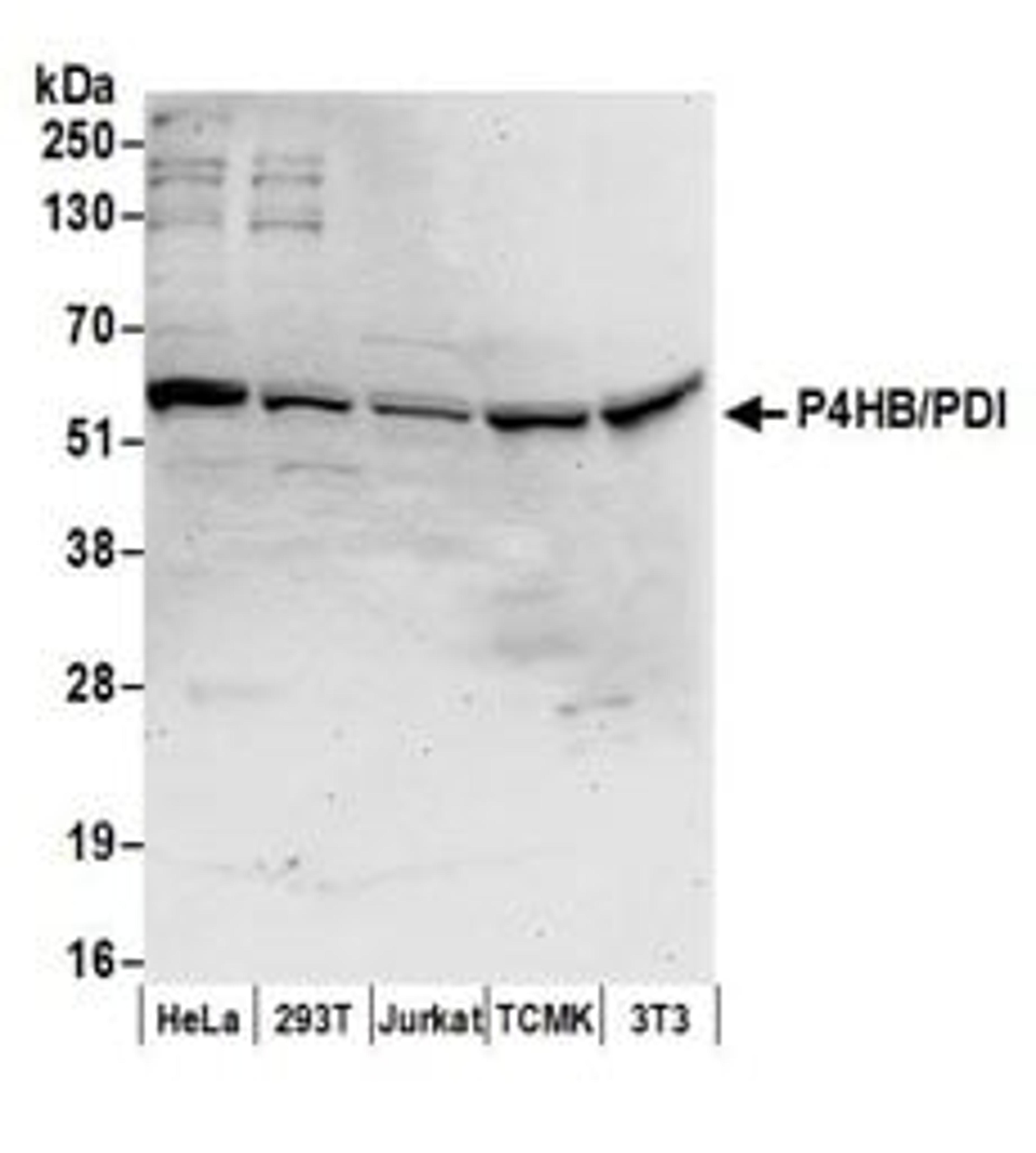 Detection of human and mouse P4HB/PDI by western blot.