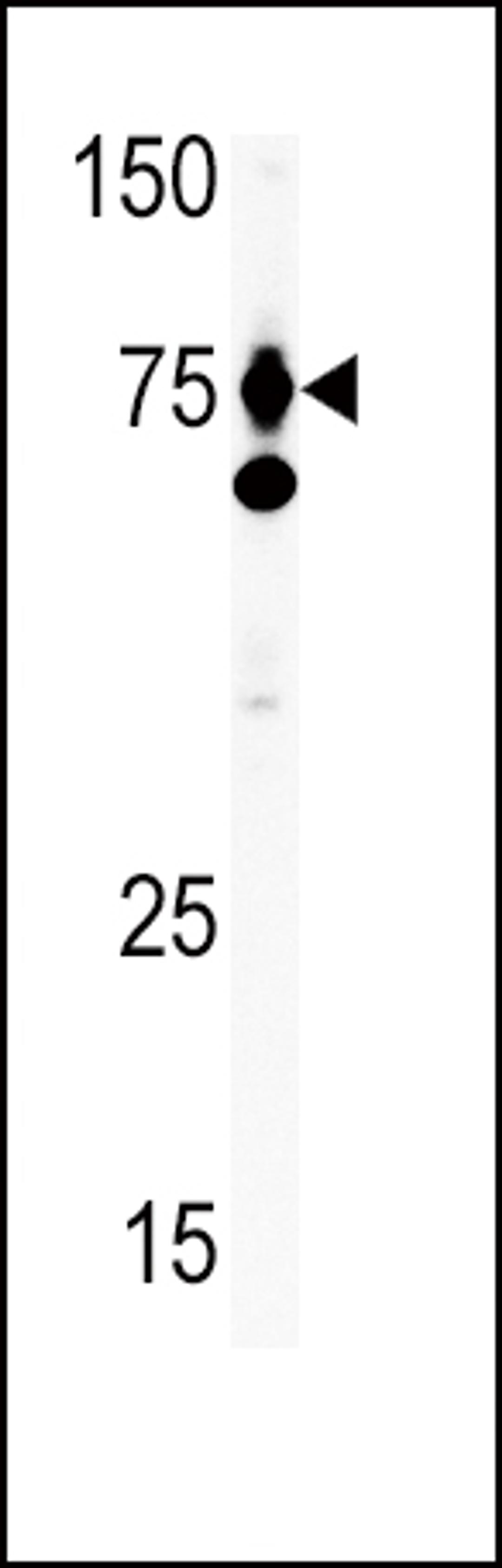 Antibody is used in Western blot to detect HGF in Ramos tissue lysate. HGF (arrow) was detected using the purified Pab.