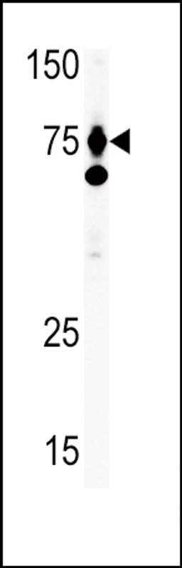 Antibody is used in Western blot to detect HGF in Ramos tissue lysate. HGF (arrow) was detected using the purified Pab.