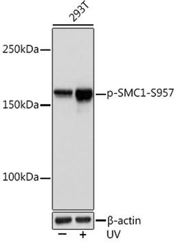 Western blot - Phospho-SMC1-S957 Rabbit mAb (AP1145)