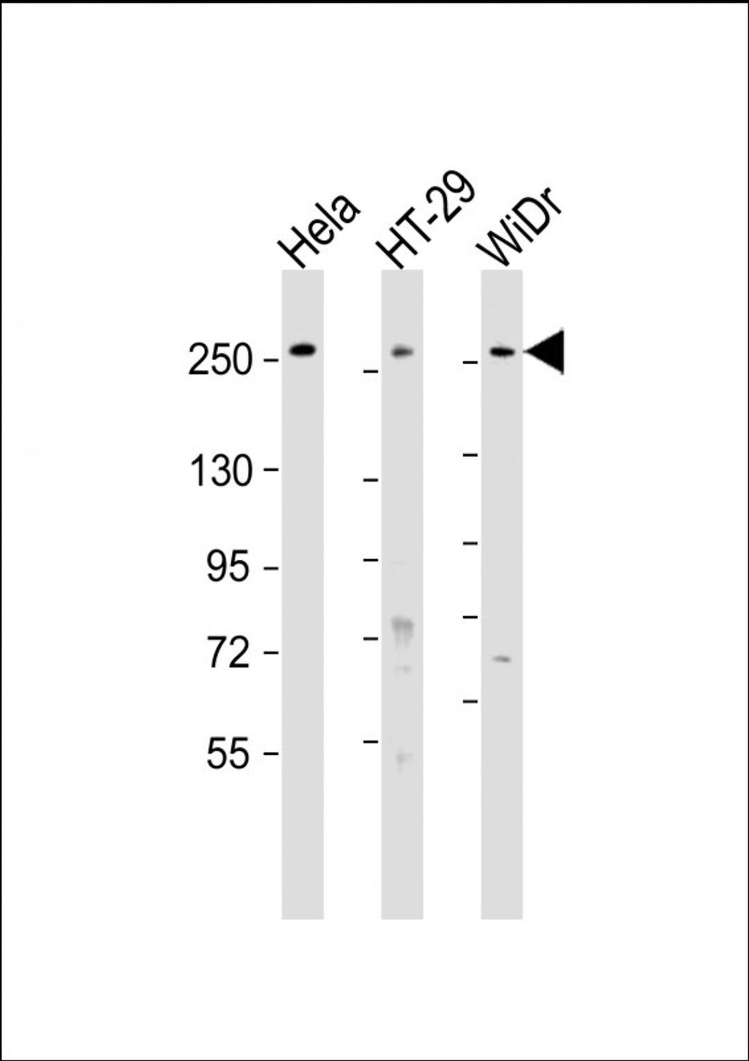 Western Blot at 1:1000-1:2000 dilution Lane 1: Hela whole cell lysate Lane 2: HT-29 whole cell lysate Lane 3: WiDr whole cell lysate Lysates/proteins at 20 ug per lane.