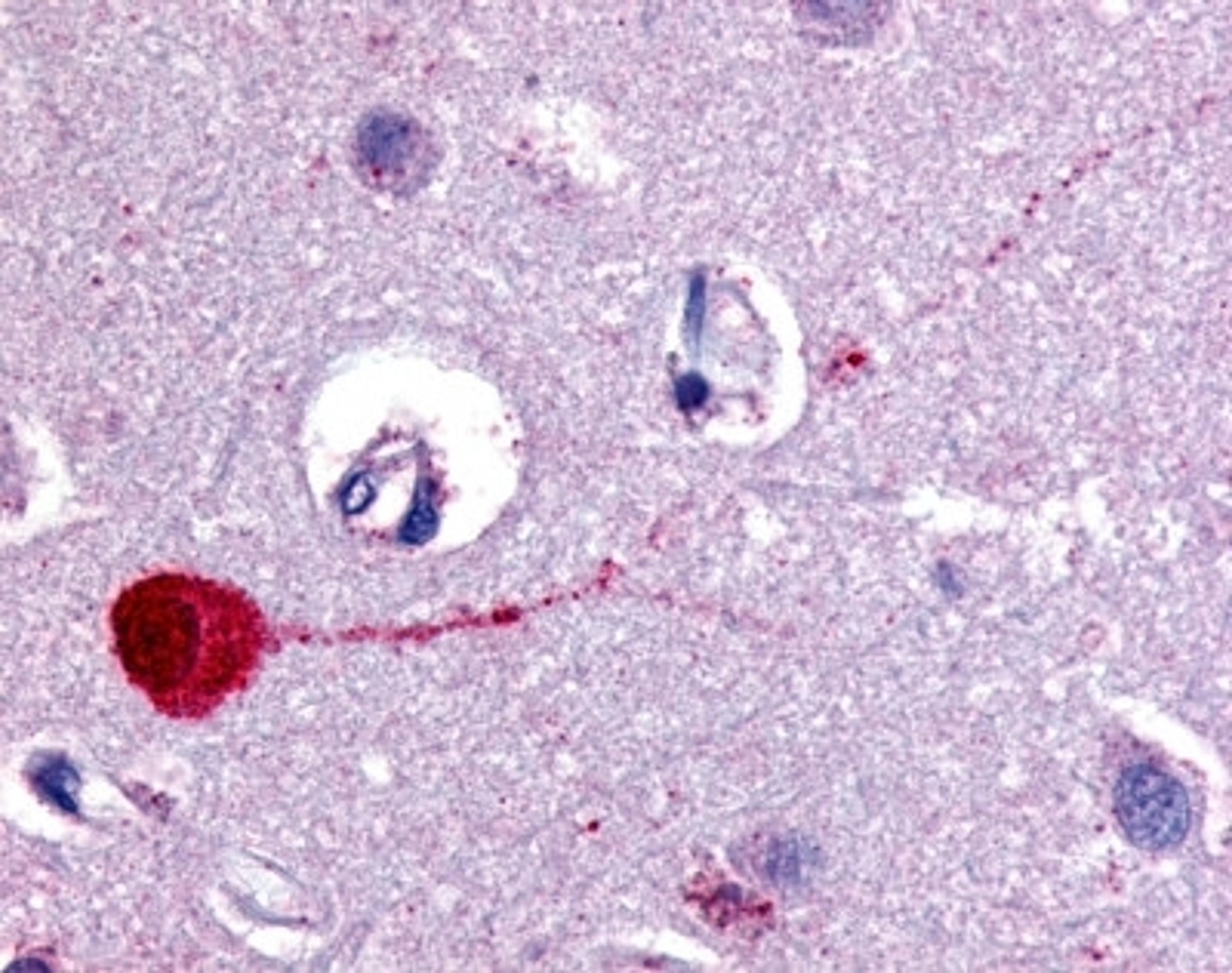 Staining of formalin fixed, paraffin embedded human brain cortex