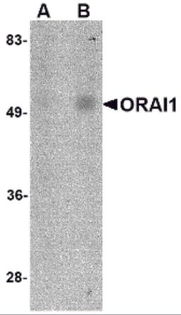 Western blot analysis of ORAI1 in human spleen tissue lysate with ORAI1 antibody at (A) 1 and (B) 2 μg/mL.