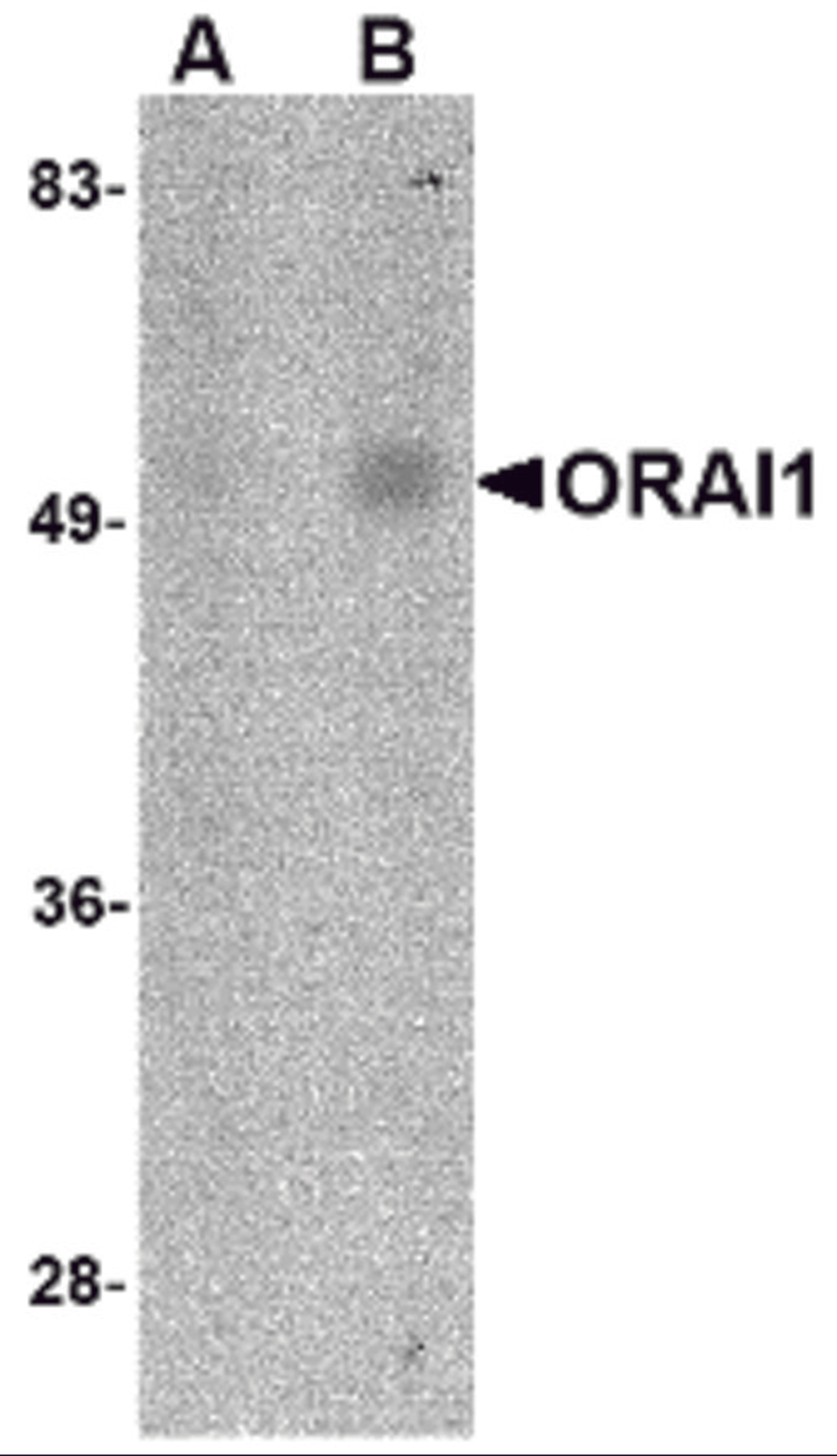 Western blot analysis of ORAI1 in human spleen tissue lysate with ORAI1 antibody at (A) 1 and (B) 2 μg/mL.