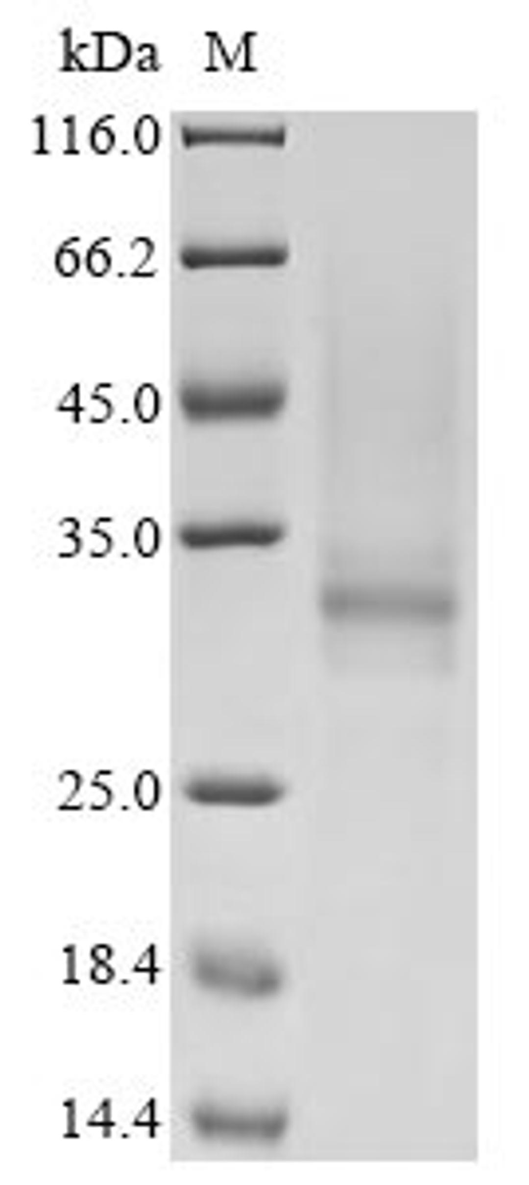 (Tris-Glycine gel) Discontinuous SDS-PAGE (reduced) with 5% enrichment gel and 15% separation gel.
