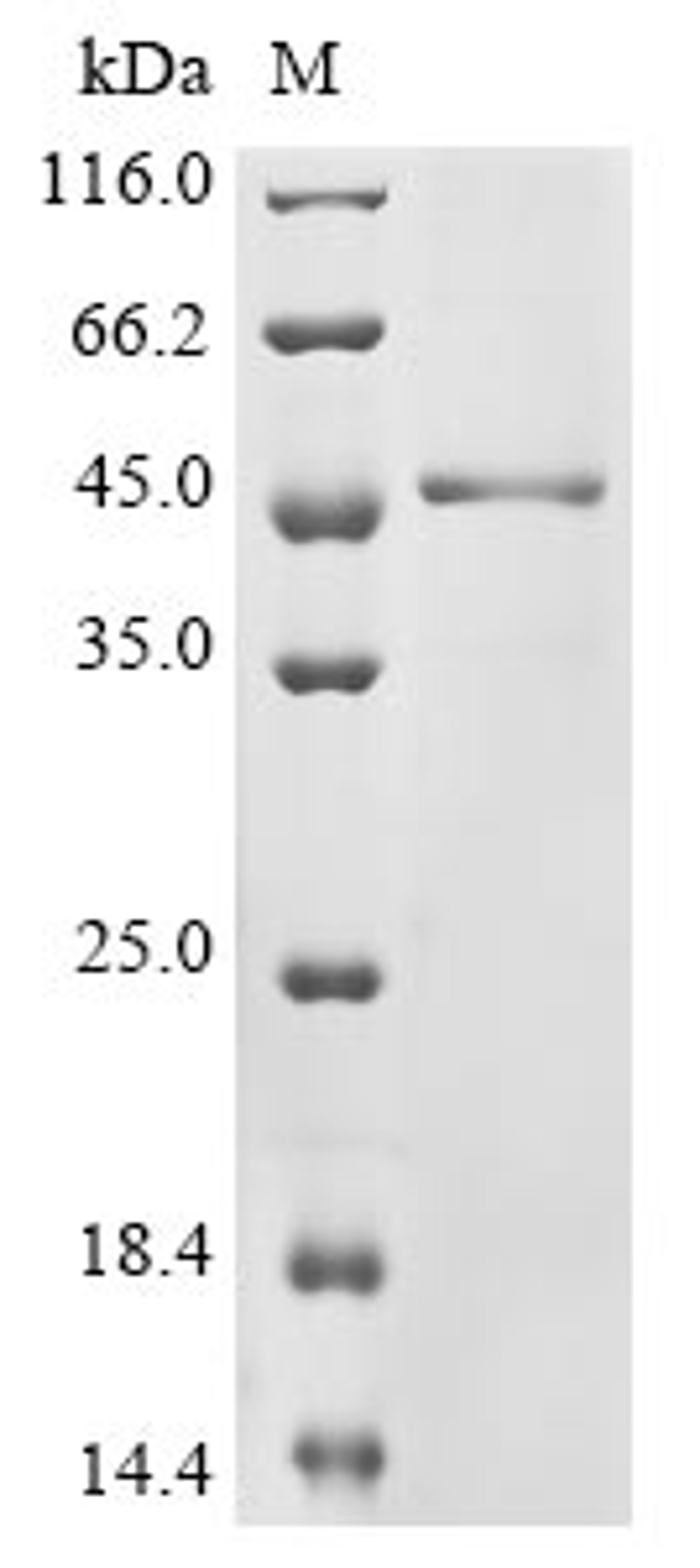 (Tris-Glycine gel) Discontinuous SDS-PAGE (reduced) with 5% enrichment gel and 15% separation gel.