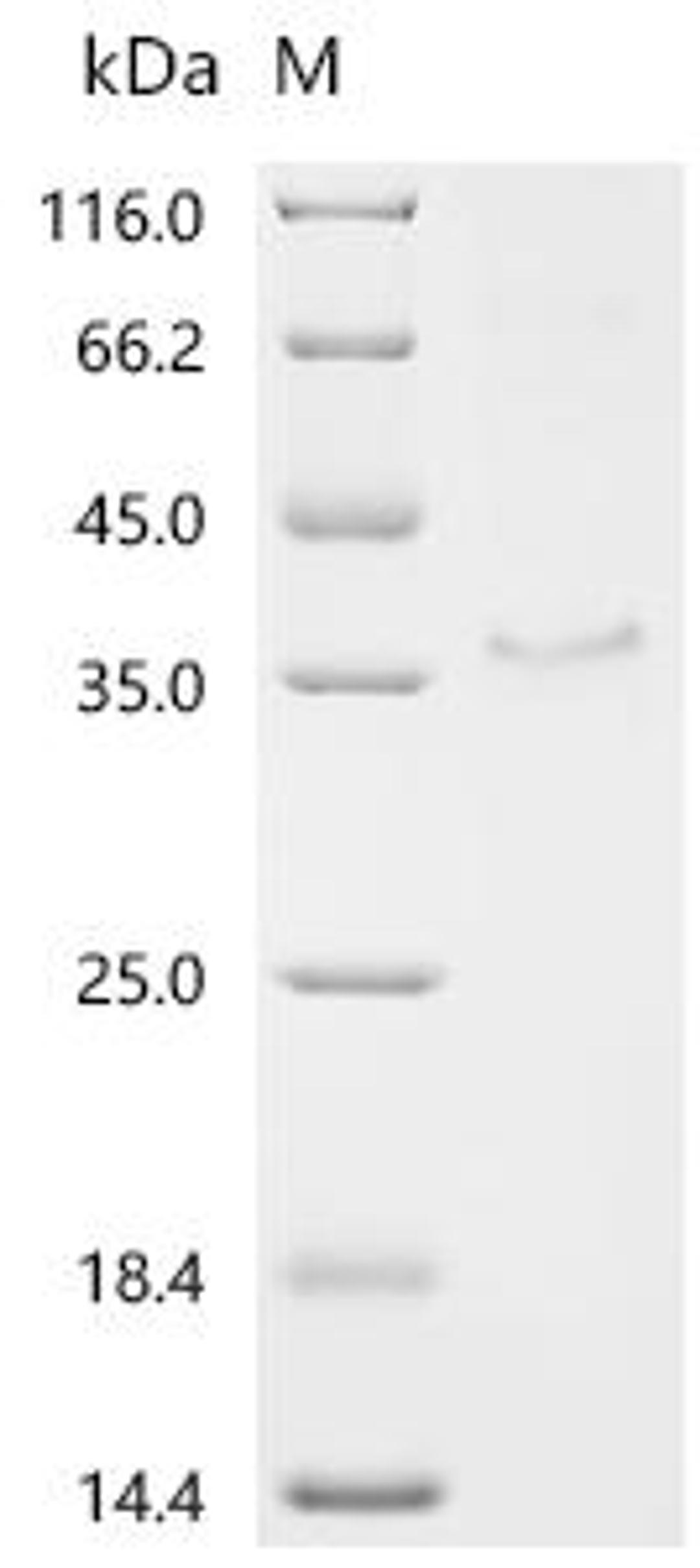 (Tris-Glycine gel) Discontinuous SDS-PAGE (reduced) with 5% enrichment gel and 15% separation gel.