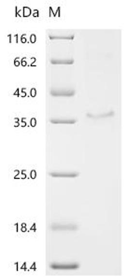(Tris-Glycine gel) Discontinuous SDS-PAGE (reduced) with 5% enrichment gel and 15% separation gel.