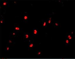 Immunocytochemistry/Immunofluorescence: CD82/Kai-1 Antibody [NBP1-76775] - Human Colon cells.