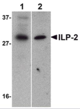 Western blot analysis of ILP-2 expression in human HepG2 (lane 1) and MOLT4 (lane 2) cell lysates with ILP-2 antibody at 1 μg/mL.