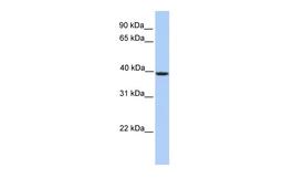 Antibody used in WB on Human Jurkat 0.2-1 ug/ml.