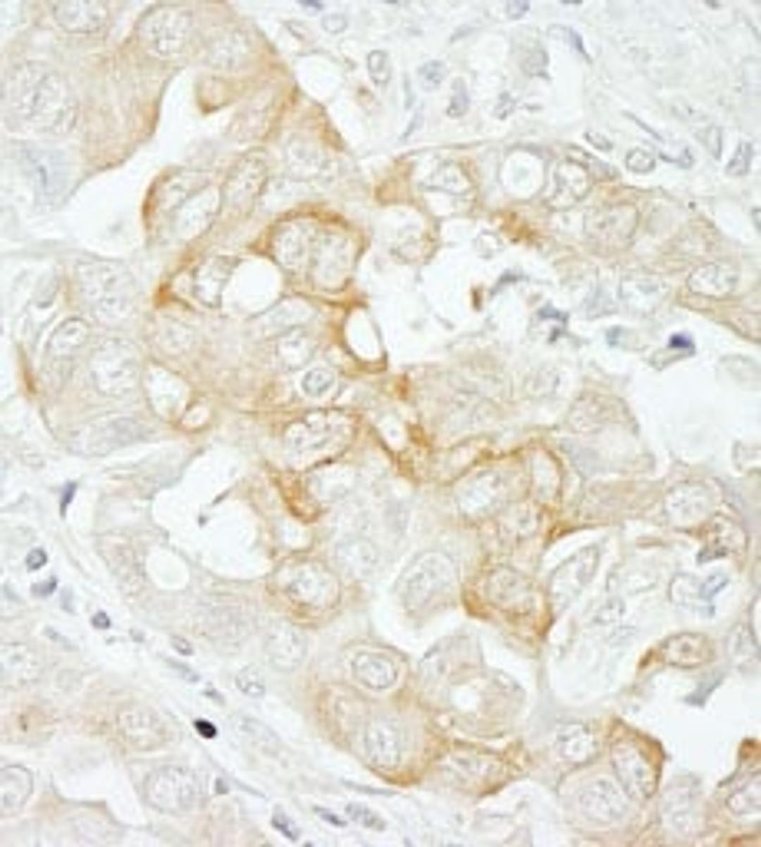 Detection of human Notch2 by immunohistochemistry.