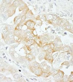 Detection of human Notch2 by immunohistochemistry.