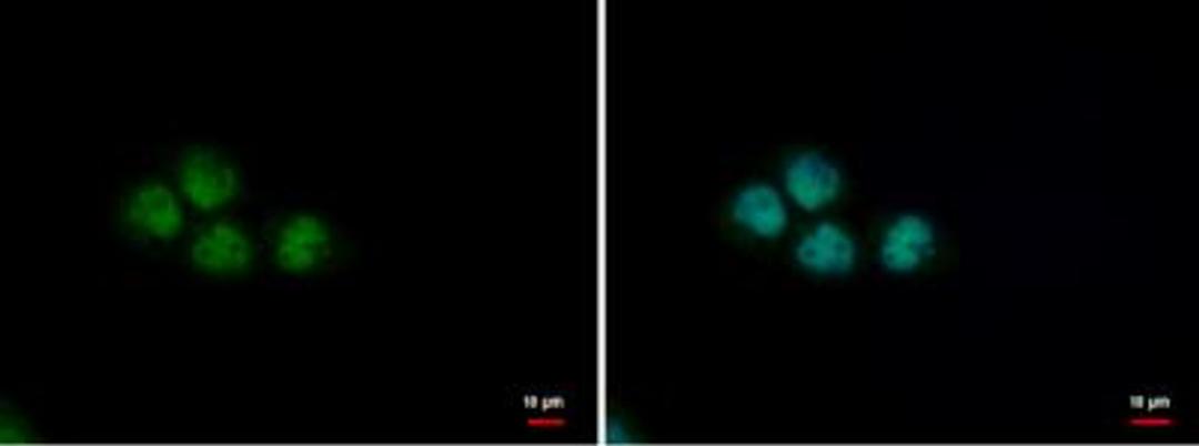 Immunocytochemistry/Immunofluorescence: PUF60 Antibody (3510) [NBP2-43835] - Analysis of Sample: A431 cells were fixed in 4% paraformaldehyde at RT for 15 min. Green: PUF60 protein stained by PUF60 antibody [3510] diluted at 1:500. Blue: Hoechst 33342 staining.