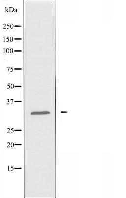 Western blot analysis of Hela cells using RASL10A antibody