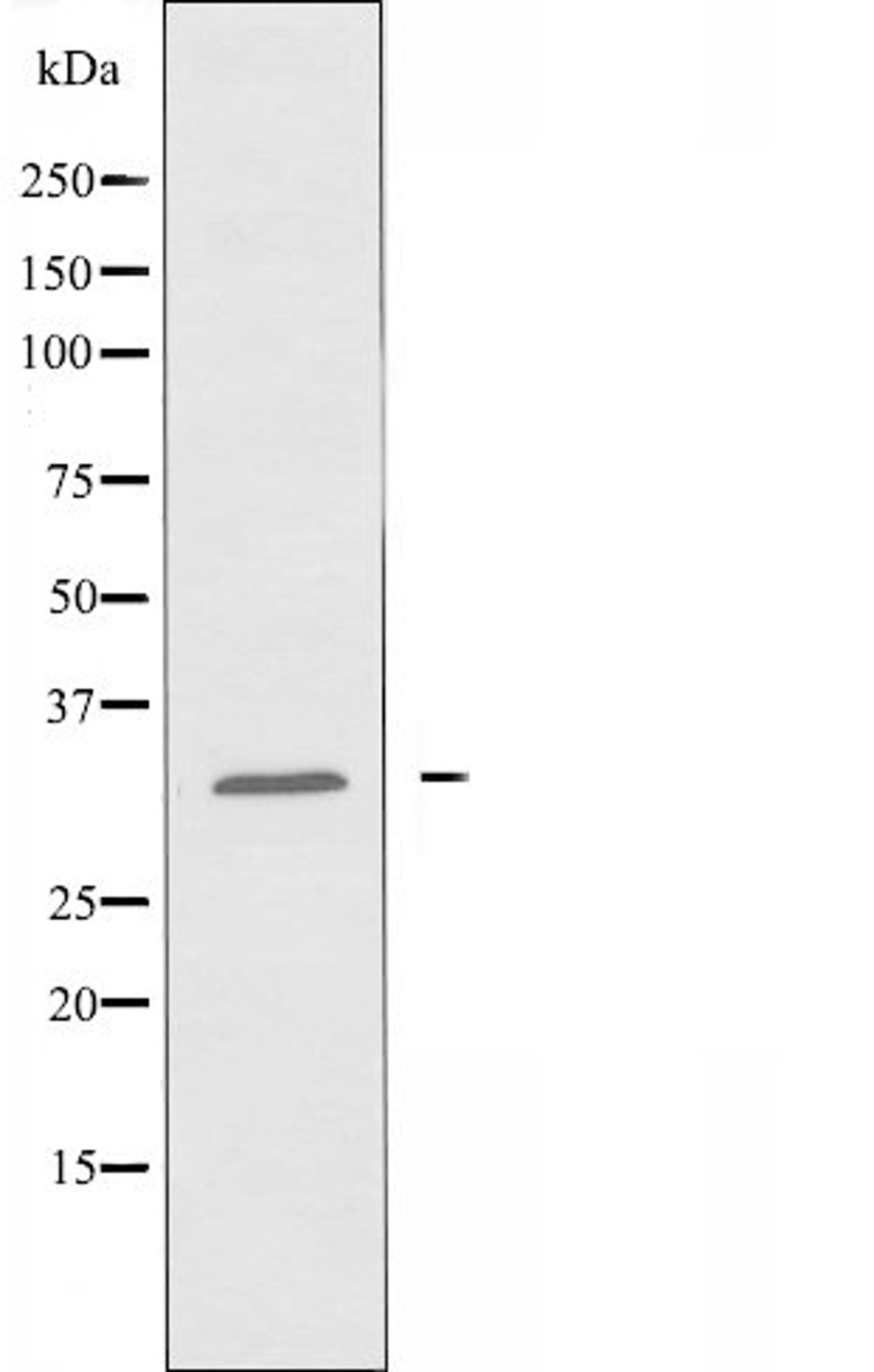 Western blot analysis of HeLa cells and COLO cells using OR8G5 antibody