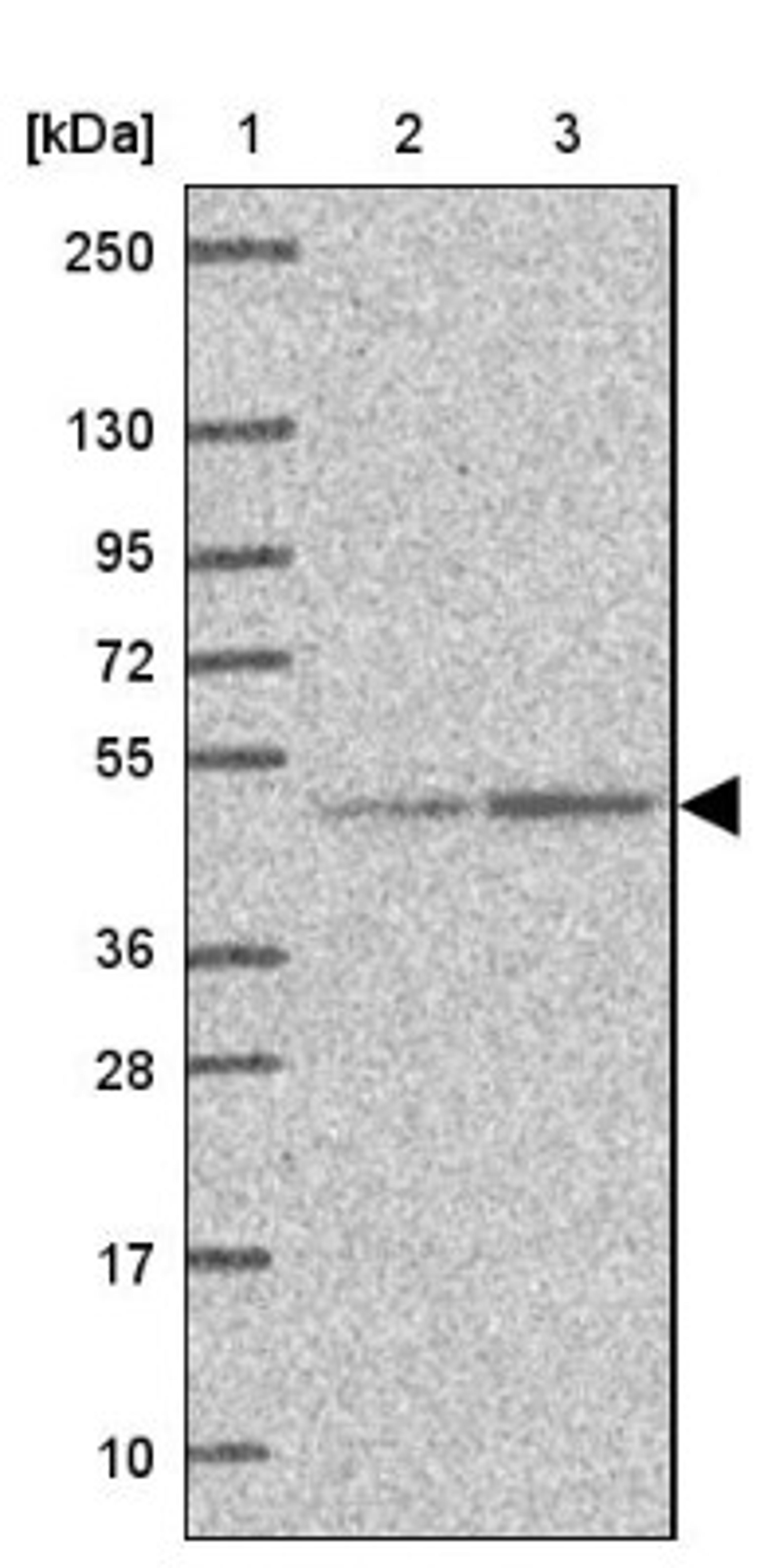 Western Blot: EEF1A2 Antibody [NBP2-33696] - Lane 1: Marker [kDa] 250, 130, 95, 72, 55, 36, 28, 17, 10<br/>Lane 2: Human cell line RT-4<br/>Lane 3: Human cell line U-251MG sp