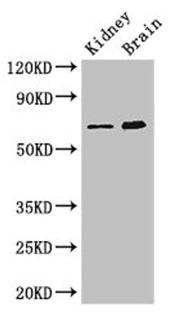 Western Blot. Positive WB detected in: Mouse kidney tissue, Mouse brain tissue. All lanes: ME3 antibody at 3ug/ml. Secondary. Goat polyclonal to rabbit IgG at 1/50000 dilution. Predicted band size: 68, 39 kDa. Observed band size: 68 kDa. 
