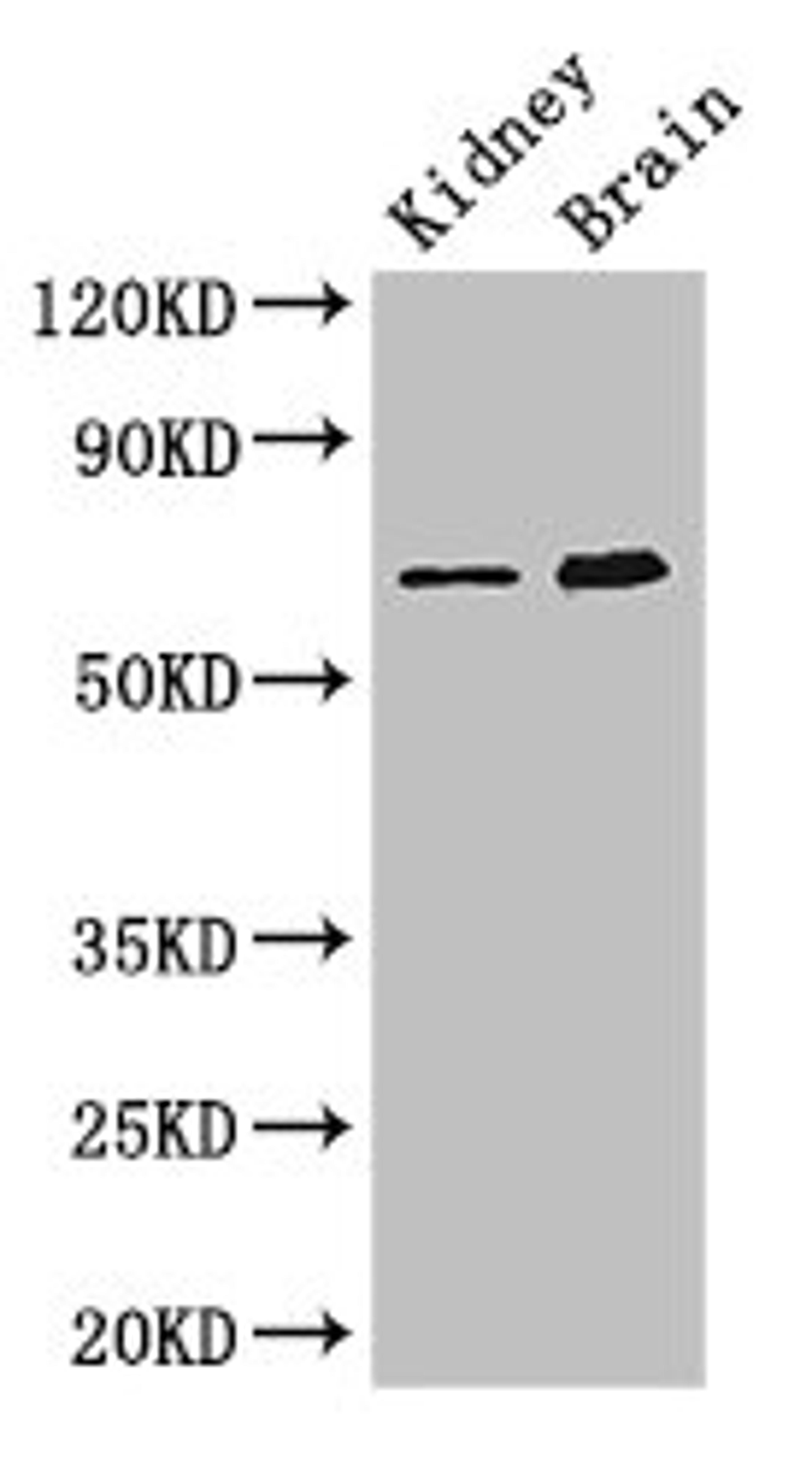 Western Blot. Positive WB detected in: Mouse kidney tissue, Mouse brain tissue. All lanes: ME3 antibody at 3ug/ml. Secondary. Goat polyclonal to rabbit IgG at 1/50000 dilution. Predicted band size: 68, 39 kDa. Observed band size: 68 kDa. 