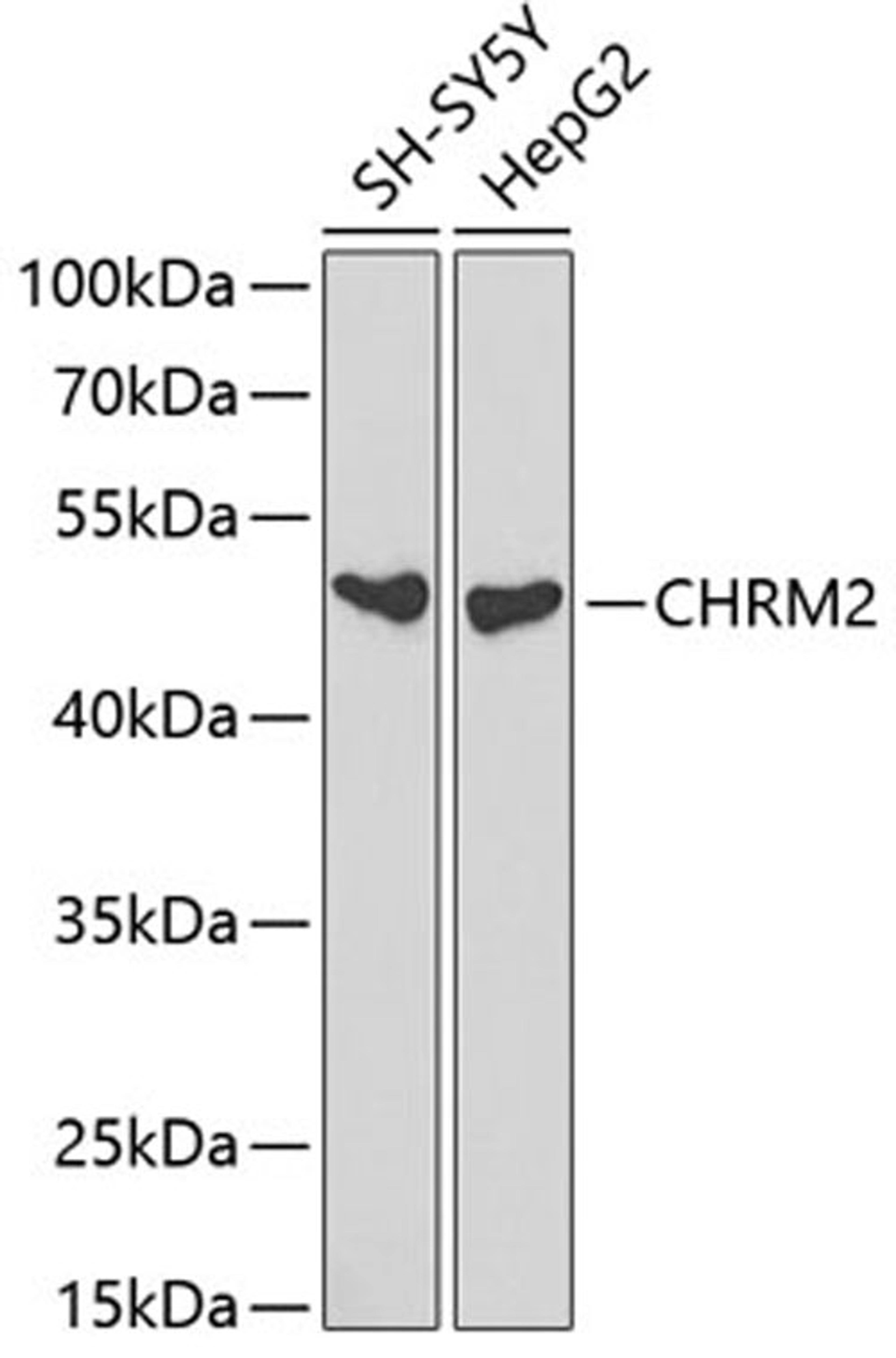 Western blot - CHRM2 antibody (A1567)