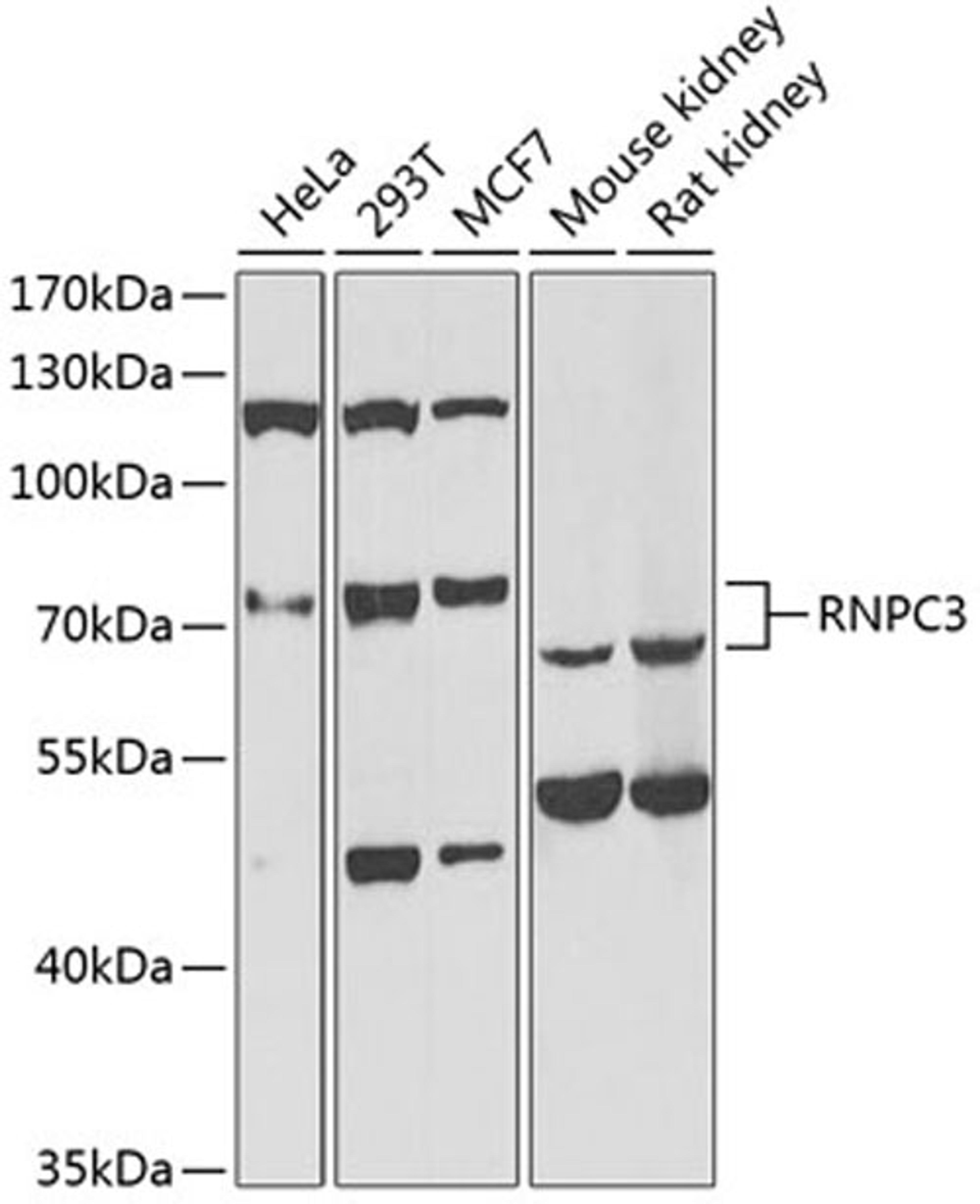 Western blot - RNPC3 antibody (A6333)