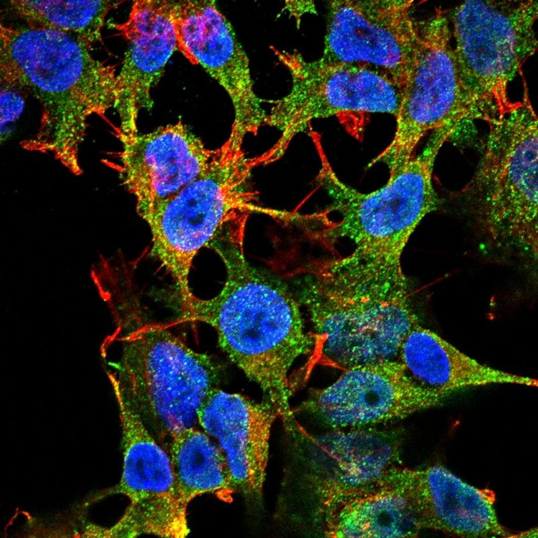 Immunofluorescence analysis of neuroblastoma cell line sk-n-be using NaVbeta2 antibody