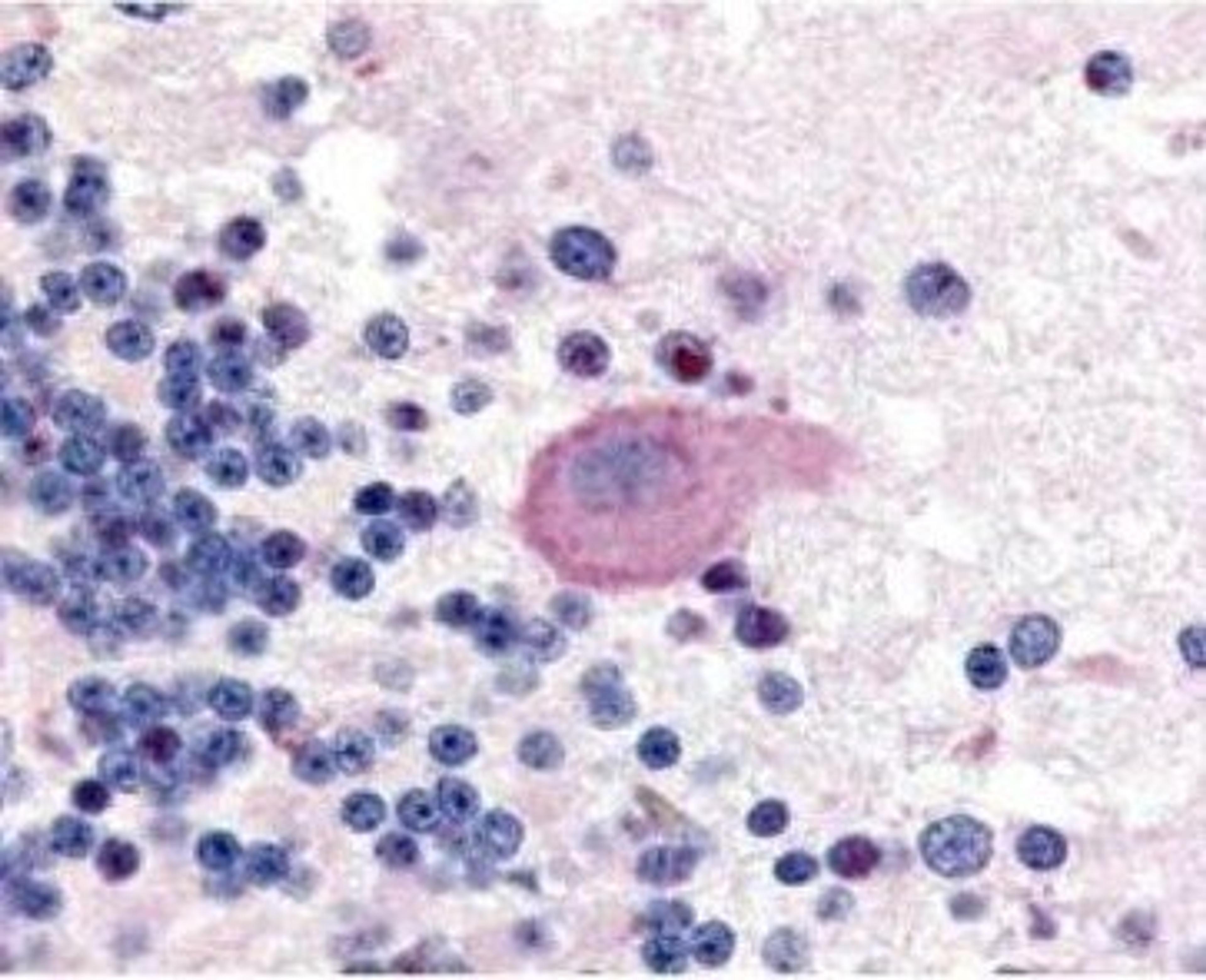 Immunohistochemical staining of human brain cerebellum tissue using Huntington (phospho-S421) antibody