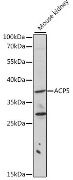 Western blot - ACP5 antibody (A2528)